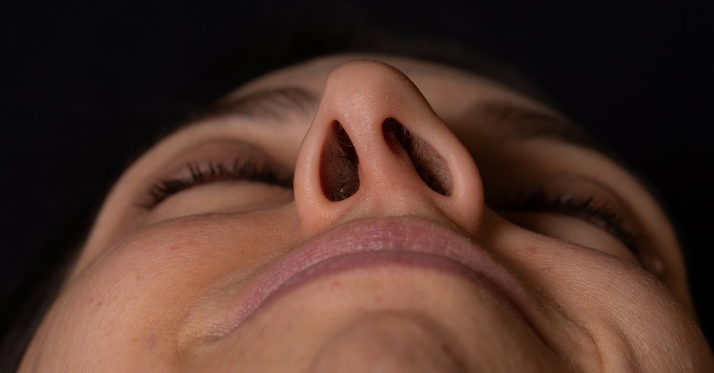 Photo of a deviated septum