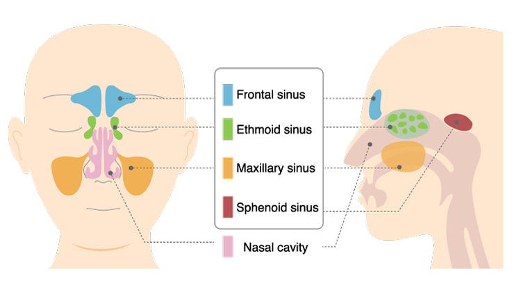 Medical illustration of nasal cavity and four types of sinuses: frontal, ethmoid, maxillary and sphednoid